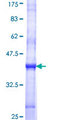 STT3A / ITM1 Protein - 12.5% SDS-PAGE Stained with Coomassie Blue.