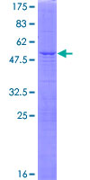 STT3B Protein - 12.5% SDS-PAGE of human STT3B stained with Coomassie Blue