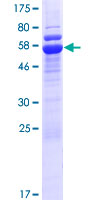 STUB1 / CHIP Protein - 12.5% SDS-PAGE of human STUB1 stained with Coomassie Blue