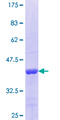 STUB1 / CHIP Protein - 12.5% SDS-PAGE Stained with Coomassie Blue.