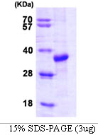 STUB1 / CHIP Protein
