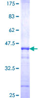 STX11 / Syntaxin 11 Protein - 12.5% SDS-PAGE Stained with Coomassie Blue.