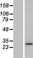 STX12 / Syntaxin 12 Protein - Western validation with an anti-DDK antibody * L: Control HEK293 lysate R: Over-expression lysate