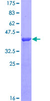 STX12 / Syntaxin 12 Protein - 12.5% SDS-PAGE Stained with Coomassie Blue.