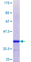 STX16 / Syntaxin 16 Protein - 12.5% SDS-PAGE Stained with Coomassie Blue.