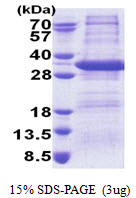 STX17 / Syntaxin 17 Protein