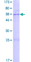 STX19 / Syntaxin 19 Protein - 12.5% SDS-PAGE of human STX19 stained with Coomassie Blue