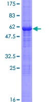 STX2 / Syntaxin 2 Protein - 12.5% SDS-PAGE of human EPIM stained with Coomassie Blue