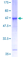 STX3 / Syntaxin 3 Protein - 12.5% SDS-PAGE of human STX3A stained with Coomassie Blue