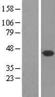 STX5 / Syntaxin 5 Protein - Western validation with an anti-DDK antibody * L: Control HEK293 lysate R: Over-expression lysate