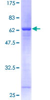 STX5 / Syntaxin 5 Protein - 12.5% SDS-PAGE of human STX5A stained with Coomassie Blue