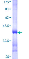 STX5 / Syntaxin 5 Protein - 12.5% SDS-PAGE Stained with Coomassie Blue.