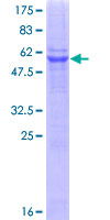 STX6 / Syntaxin 6 Protein - 12.5% SDS-PAGE of human STX6 stained with Coomassie Blue