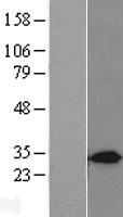 STX7 / Syntaxin 7 Protein - Western validation with an anti-DDK antibody * L: Control HEK293 lysate R: Over-expression lysate