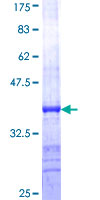 STXBP1 / MUNC18-1 Protein - 12.5% SDS-PAGE Stained with Coomassie Blue.