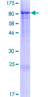 STXBP3 Protein - 12.5% SDS-PAGE of human STXBP3 stained with Coomassie Blue