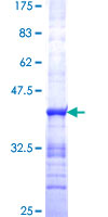 STXBP5 / Tomosyn Protein - 12.5% SDS-PAGE Stained with Coomassie Blue.