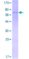 STYK1 Protein - 12.5% SDS-PAGE of human STYK1 stained with Coomassie Blue