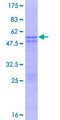 STYX Protein - 12.5% SDS-PAGE of human STYX stained with Coomassie Blue