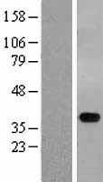 STYXL1 Protein - Western validation with an anti-DDK antibody * L: Control HEK293 lysate R: Over-expression lysate