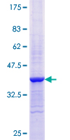 SUB1 Protein - 12.5% SDS-PAGE Stained with Coomassie Blue.