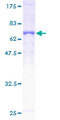 SUCLA2 Protein - 12.5% SDS-PAGE of human SUCLA2 stained with Coomassie Blue