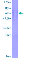 SUCLG1 / GALPHA Protein - 12.5% SDS-PAGE of human SUCLG1 stained with Coomassie Blue
