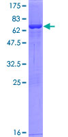 SUCLG2 Protein - 12.5% SDS-PAGE of human SUCLG2 stained with Coomassie Blue