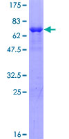 SUDS3 Protein - 12.5% SDS-PAGE of human SUDS3 stained with Coomassie Blue