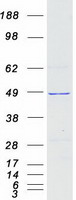 SUDS3 Protein - Purified recombinant protein SUDS3 was analyzed by SDS-PAGE gel and Coomassie Blue Staining