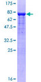 SUFU Protein - 12.5% SDS-PAGE of human SUFU stained with Coomassie Blue