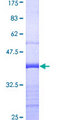 SUFU Protein - 12.5% SDS-PAGE Stained with Coomassie Blue.