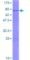 SUGCT / C7orf10 Protein - 12.5% SDS-PAGE of human C7orf10 stained with Coomassie Blue