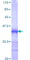 SUGT1 / SGT1 Protein - 12.5% SDS-PAGE Stained with Coomassie Blue.