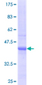 SULF2 / Sulfatase 2 Protein - 12.5% SDS-PAGE of human SULF2 stained with Coomassie Blue