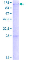 SULF2 / Sulfatase 2 Protein - 12.5% SDS-PAGE of human SULF2 stained with Coomassie Blue