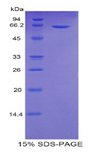 SULF2 / Sulfatase 2 Protein - Recombinant Sulfatase 2 By SDS-PAGE