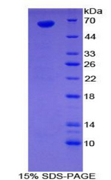 Sulfatase 1 / SULF1 Protein - Recombinant Sulfatase 1 By SDS-PAGE