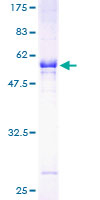 SULT1A1 / Sulfotransferase 1A1 Protein - 12.5% SDS-PAGE of human SULT1A1 stained with Coomassie Blue