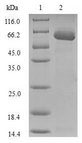 SULT1A1 / Sulfotransferase 1A1 Protein - (Tris-Glycine gel) Discontinuous SDS-PAGE (reduced) with 5% enrichment gel and 15% separation gel.