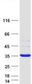 SULT1A1 / Sulfotransferase 1A1 Protein - Purified recombinant protein SULT1A1 was analyzed by SDS-PAGE gel and Coomassie Blue Staining