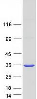 SULT1A1 / Sulfotransferase 1A1 Protein - Purified recombinant protein SULT1A1 was analyzed by SDS-PAGE gel and Coomassie Blue Staining