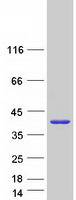 SULT1A4 / Sulfotransferase 1A4 Protein - Purified recombinant protein SULT1A4 was analyzed by SDS-PAGE gel and Coomassie Blue Staining