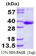 SULT1B1 / Sulfotransferase 1B1 Protein