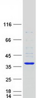 SULT1B1 / Sulfotransferase 1B1 Protein - Purified recombinant protein SULT1B1 was analyzed by SDS-PAGE gel and Coomassie Blue Staining