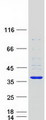 SULT1B1 / Sulfotransferase 1B1 Protein - Purified recombinant protein SULT1B1 was analyzed by SDS-PAGE gel and Coomassie Blue Staining