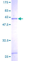 SULT1C2 / Sulfotransferase 1C2 Protein - 12.5% SDS-PAGE of human SULT1C1 stained with Coomassie Blue
