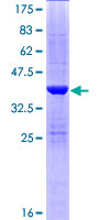 SULT1C4 / Sulfotransferase 1C4 Protein - 12.5% SDS-PAGE of human SULT1C4 stained with Coomassie Blue