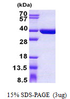 SULT1C4 / Sulfotransferase 1C4 Protein