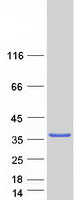SULT1C4 / Sulfotransferase 1C4 Protein - Purified recombinant protein SULT1C4 was analyzed by SDS-PAGE gel and Coomassie Blue Staining